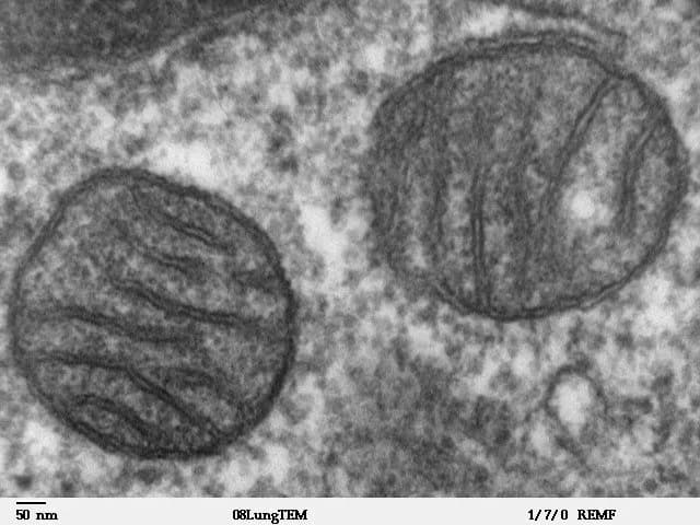 Transmission electron micrograph of two mitochondria in mammalian lung tissue. Each has a smooth outer boundary and a granular matrix crossed by dark, folded inner membranes (cristae).