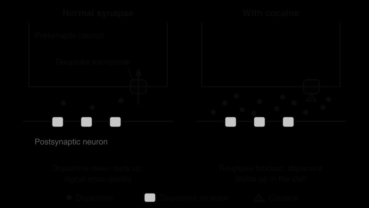 Two synapses. Normal: a few dopamine molecules in the cleft between dopamine receptors, and an arrow through a reuptake transporter back into the presynaptic neuron. With cocaine: a cocaine molecule blocks the transporter and many dopamine molecules build up in the cleft.