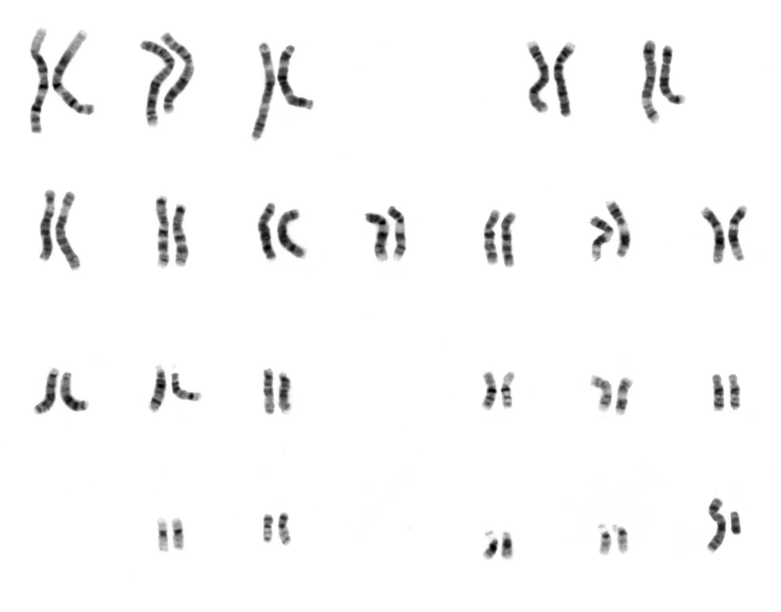 A human karyogram: 22 numbered pairs of banded chromosomes arranged in rows from the longest (1) to the shortest, followed by an X chromosome and a smaller Y chromosome.