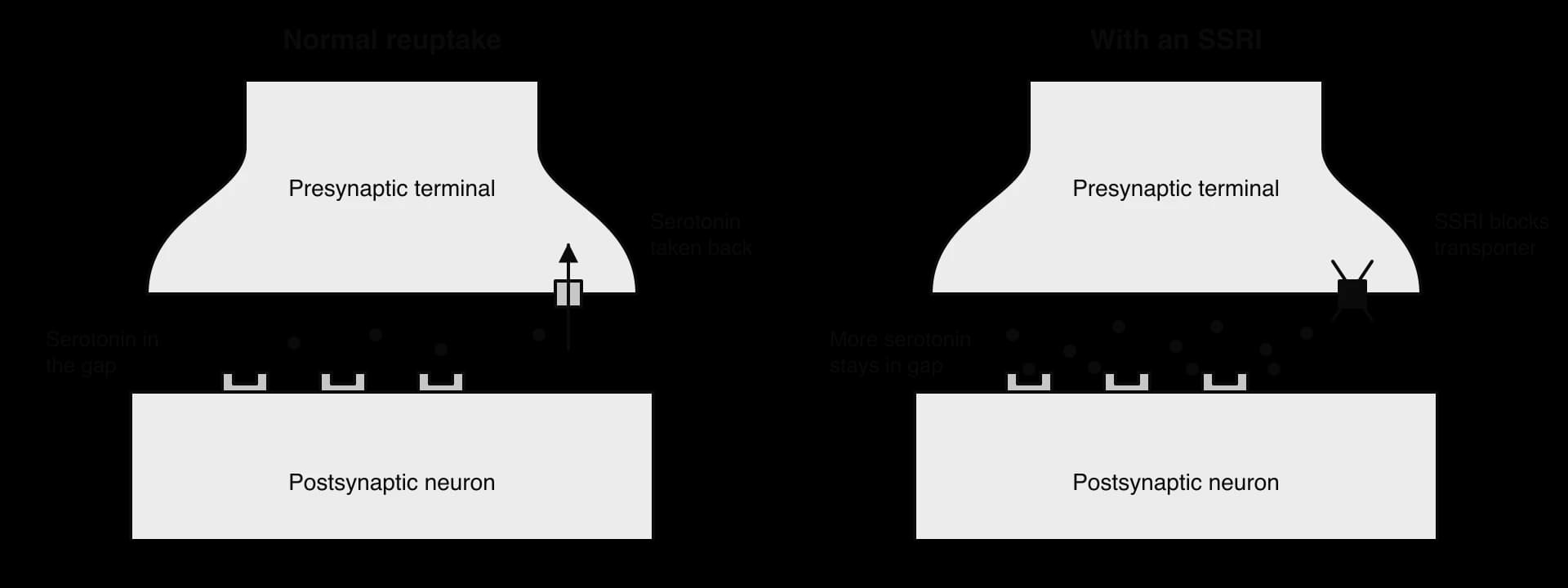 Two synapses. Left: normal reuptake, a transporter carries serotonin back into the presynaptic terminal. Right: an SSRI blocks the transporter, so more serotonin stays in the synaptic gap near the receptors.