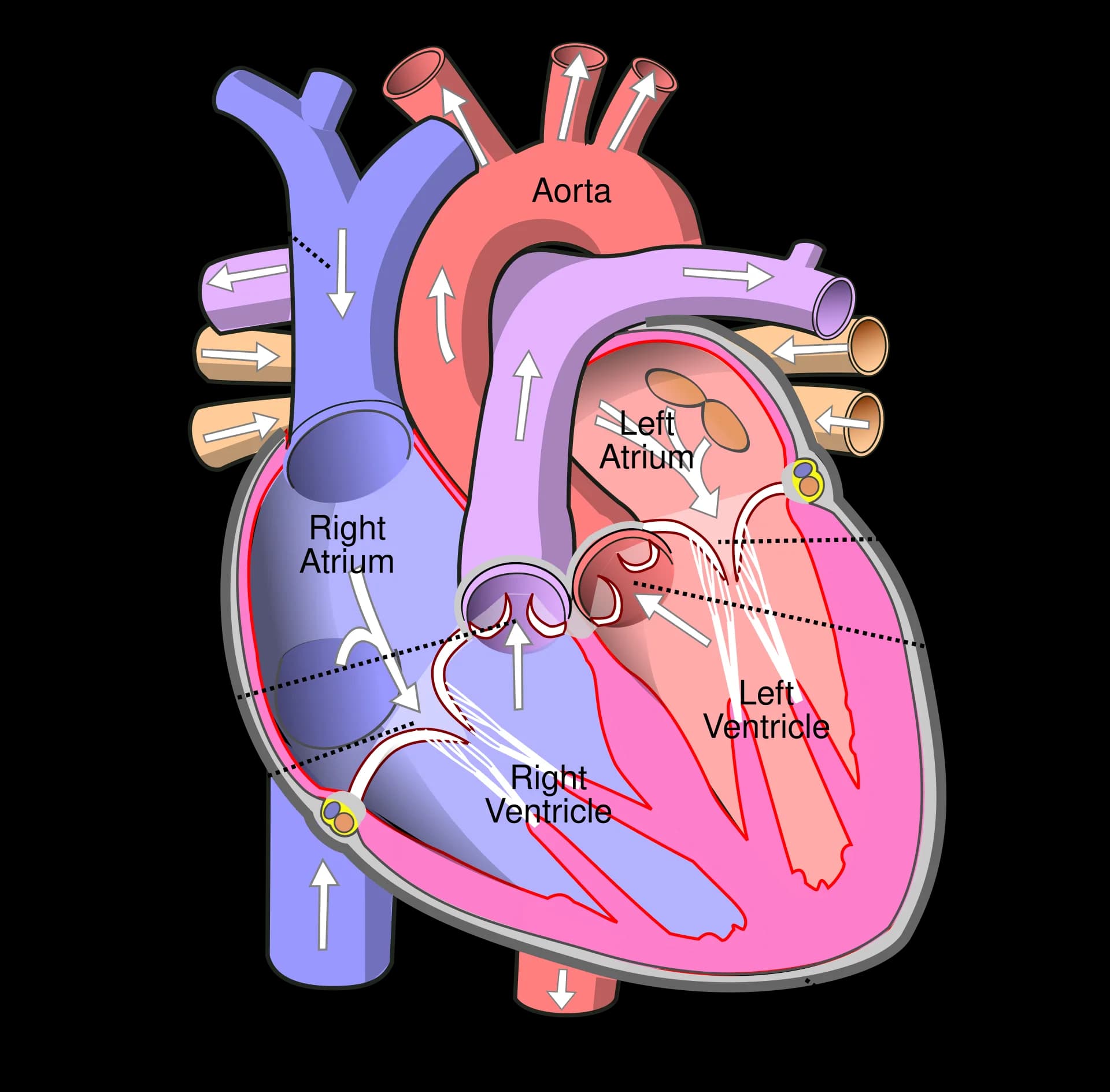 Front view of the human heart in section: right and left atria, right and left ventricles, tricuspid, pulmonary, mitral and aortic valves, superior and inferior vena cava, aorta, pulmonary artery, pulmonary veins and pericardium, with arrows showing blood flow.