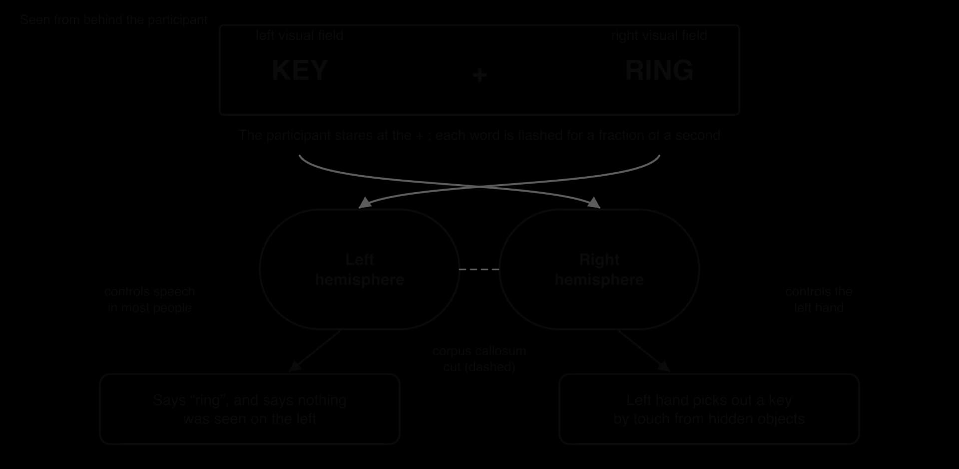 Split-brain procedure: KEY flashed to the left visual field reaches the right hemisphere, RING to the right visual field reaches the left hemisphere. With the corpus callosum cut, the patient says ring and the left hand picks out a key by touch.