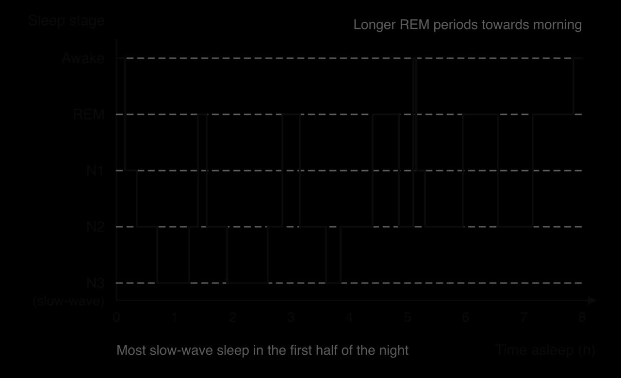 Hypnogram of an 8-hour night: the sleeper cycles through N1, N2, N3 (slow-wave) and REM sleep about five times. Long N3 periods occur in the first half of the night; REM periods lengthen towards morning; brief awakenings near 5 h and at the end.