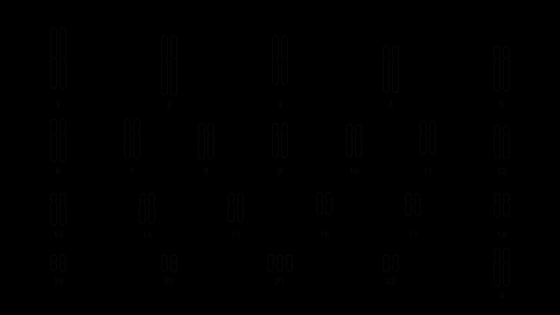 Schematic karyogram in four rows: chromosome pairs 1 to 22 arranged by length with centromeres aligned, three copies of chromosome 21, and two X chromosomes at the end. There is no Y chromosome.