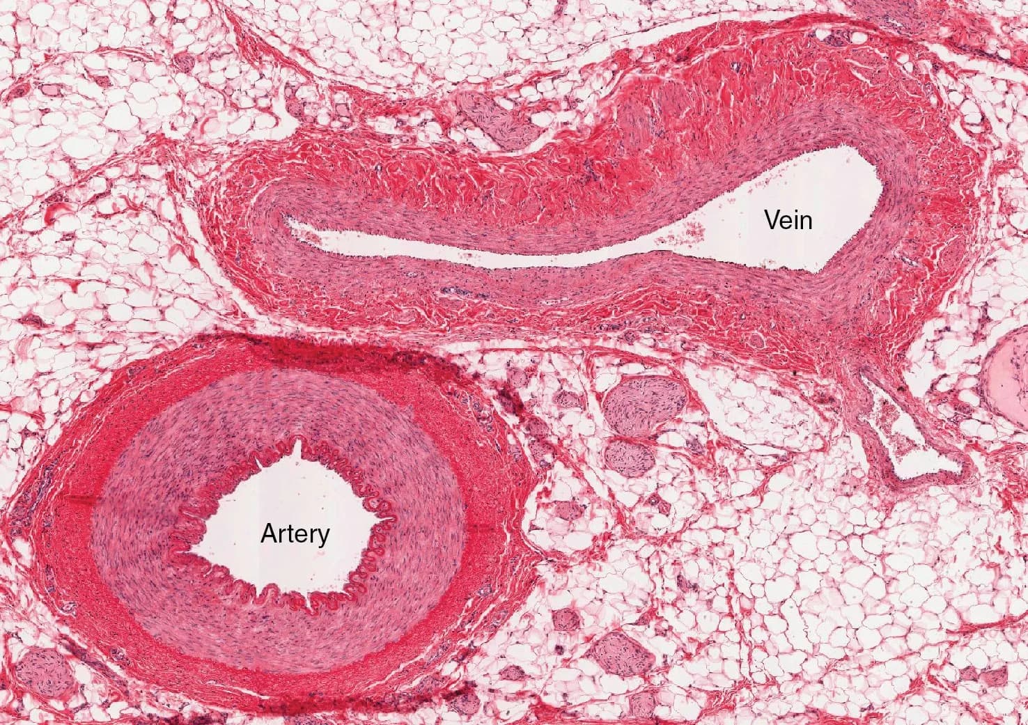 Light micrograph of a section stained pink: a round artery with a thick muscular wall and a small star-shaped lumen (lower left), and a flattened vein with a thin wall and a wide, irregular lumen (upper right), surrounded by fat cells.