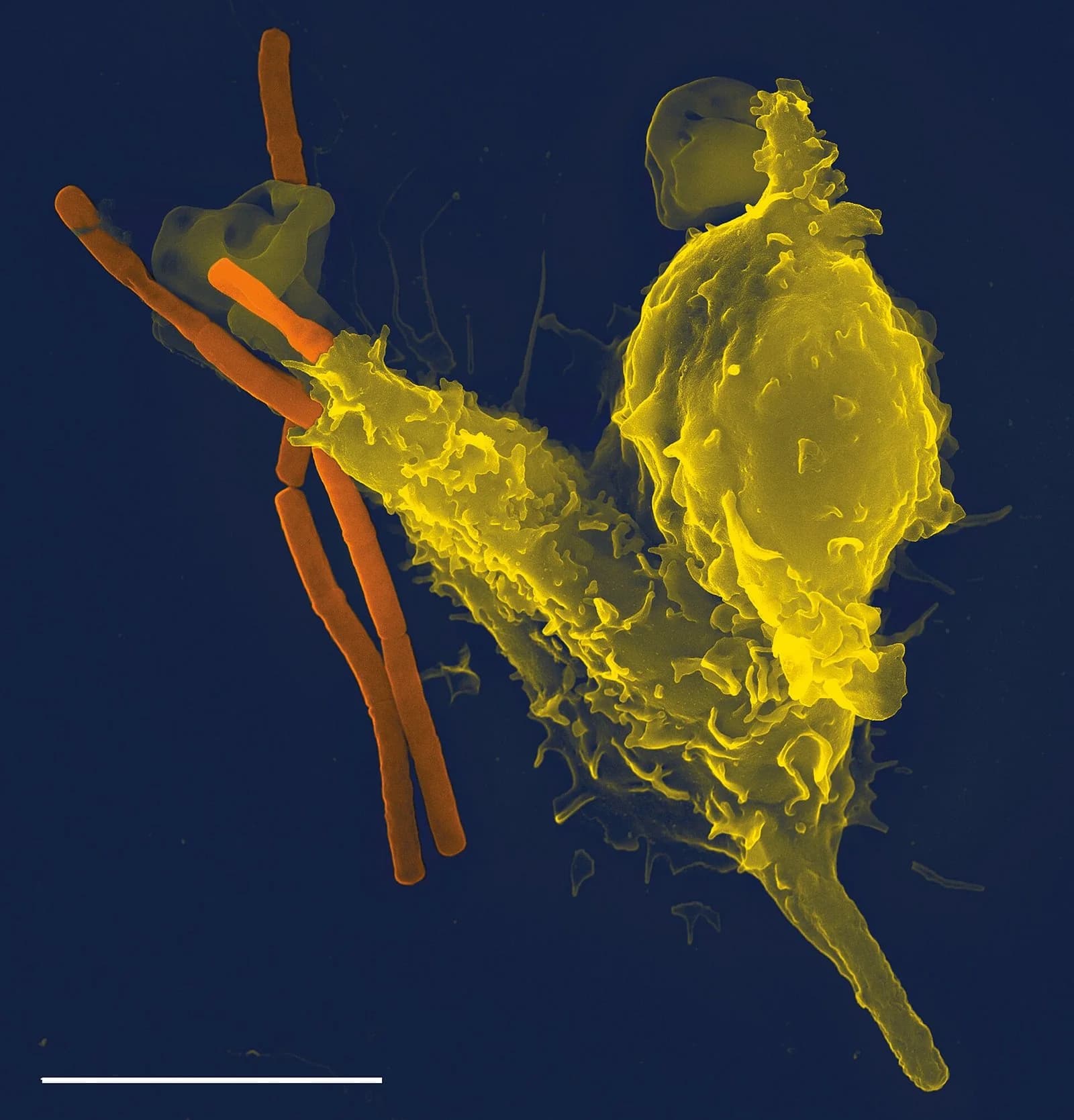Scanning electron micrograph of a human neutrophil, a rounded cell with a folded surface, extending around several rod-shaped Bacillus anthracis bacteria.