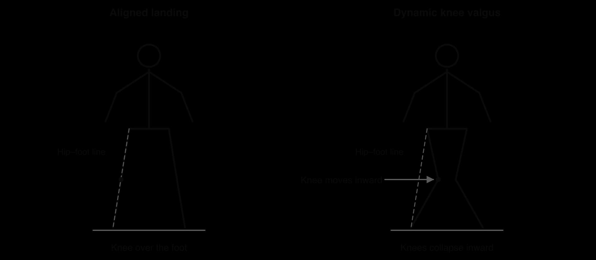 Front-view stick figures of two landings. Aligned landing: each knee lies on the line from hip to foot. Dynamic knee valgus: the knees move inward towards each other, inside the hip–foot line, while the feet stay apart.