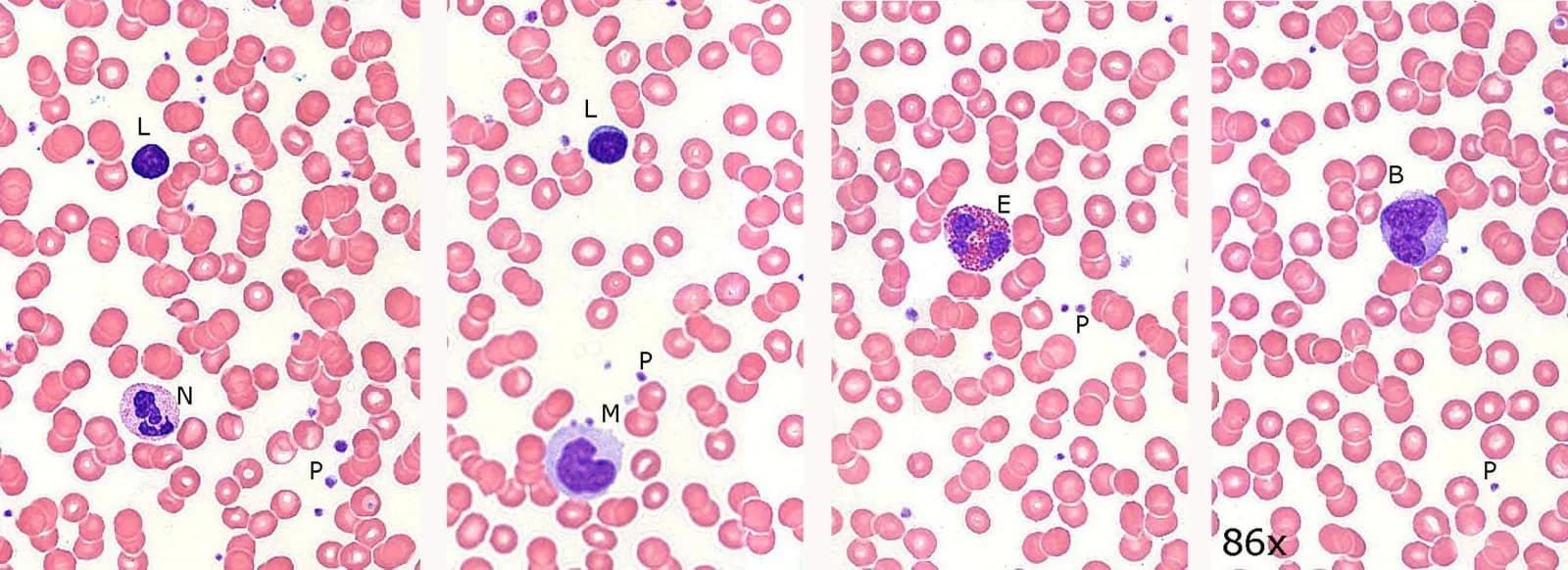 Four fields of a stained human blood smear. Many small, pale red blood cells without nuclei surround larger white blood cells with dark purple nuclei, labelled L (lymphocyte), N (neutrophil), M (monocyte), E (eosinophil) and B (basophil); tiny platelets are labelled P.