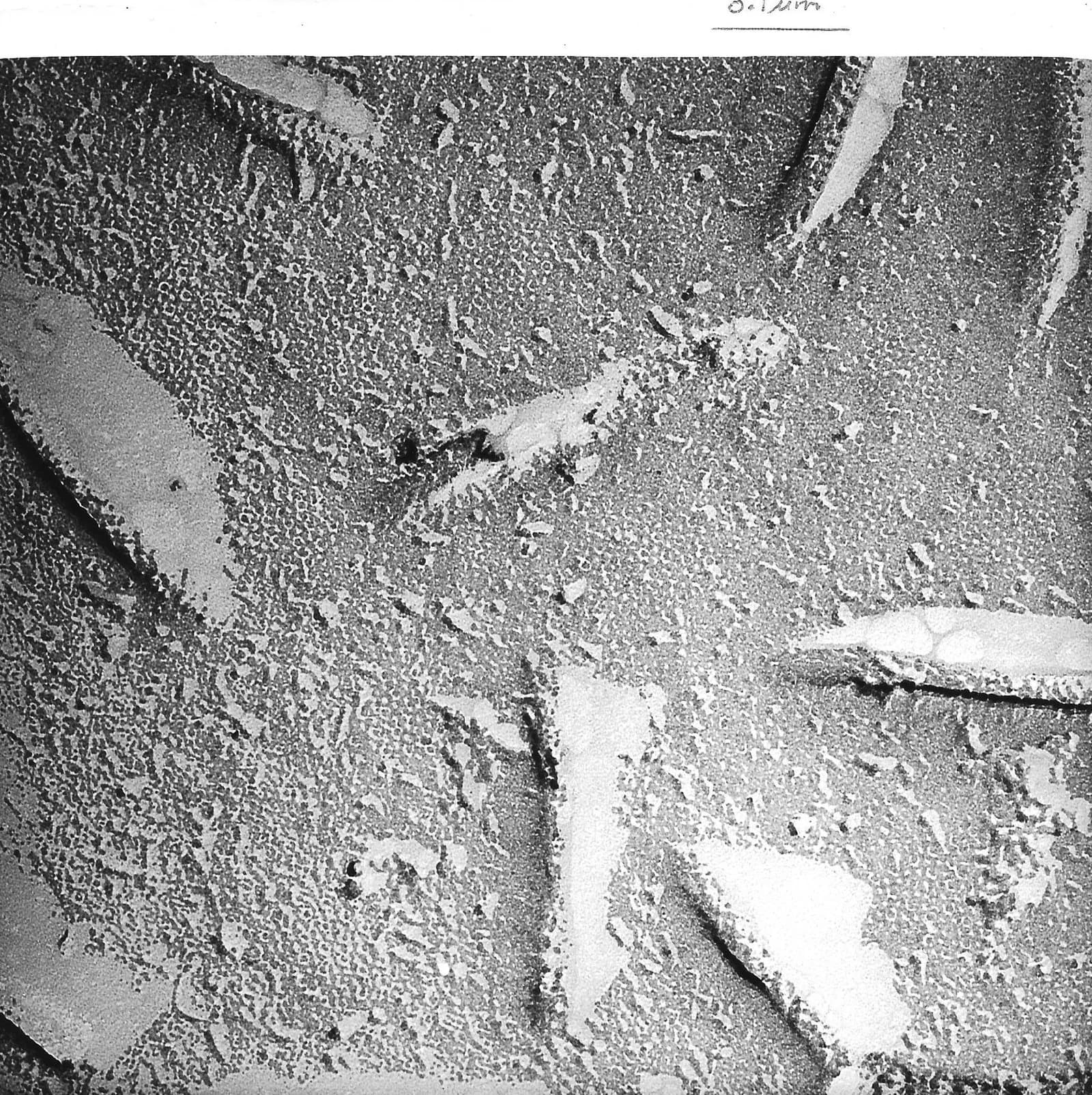Freeze-fracture replica of a membrane of baker's yeast, seen with an electron microscope. The fractured inner face of the membrane is covered in small granular particles; a 0.1 µm scale bar is at the top.