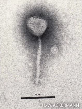 Transmission electron micrograph of a single bacteriophage lambda particle: a rounded pale head at the top attached to a long thin straight tail, with a 100 nm scale bar.