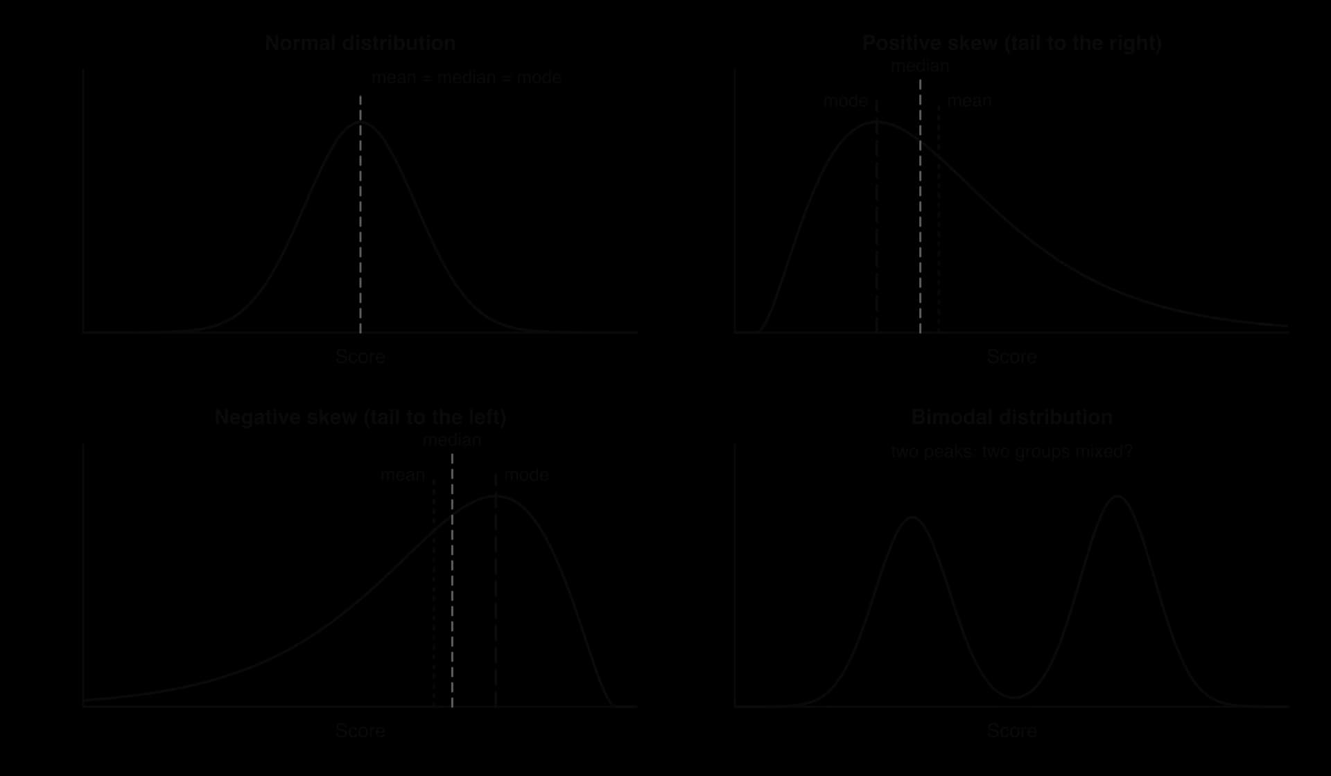 Four distribution curves: normal, symmetrical with mean, median and mode equal; positive skew, tail to the right, mode then median then mean; negative skew, tail to the left, mean then median then mode; bimodal, two peaks.