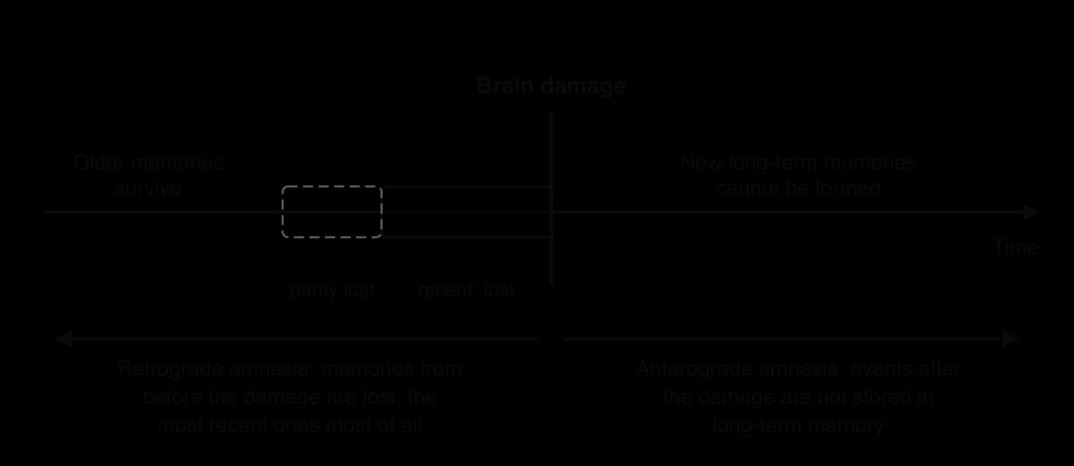 Timeline with brain damage marked: to the left, retrograde amnesia, recent memories lost and older ones partly lost or surviving; to the right, anterograde amnesia, no new long-term memories formed after the damage.
