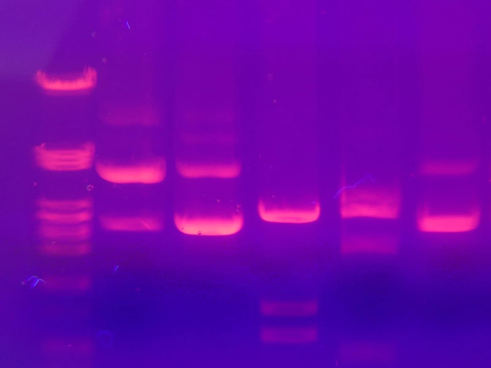 Photograph of an agarose gel under ultraviolet light. Pink-glowing bands of stained DNA in six lanes on a purple background. The left lane holds a DNA ladder of many evenly spaced bands; the other lanes hold one to three bands each at different distances.