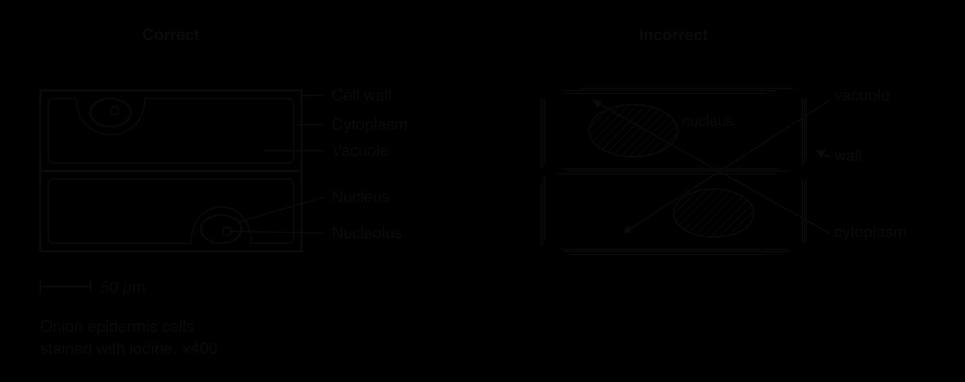 Left, correct drawing of two onion cells: single lines; cell wall, cytoplasm, vacuole, nucleus and nucleolus labelled with ruled lines in a column; 50 µm scale bar and title. Right, incorrect: sketchy lines, shaded large nuclei, arrows, crossing lines, no title or scale.