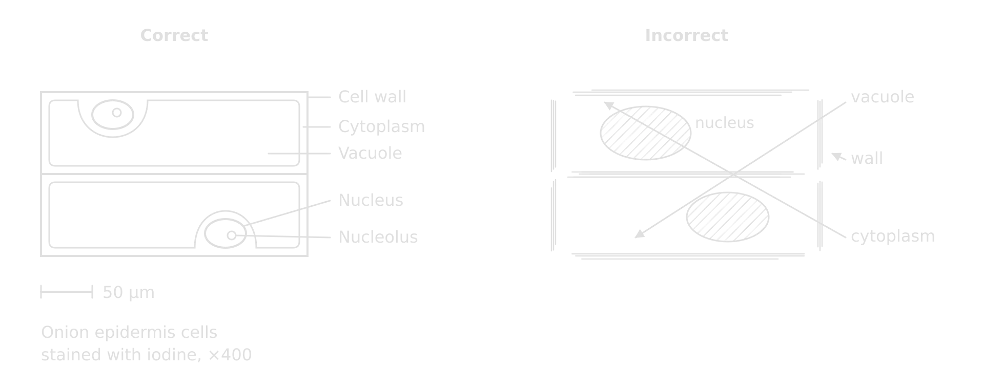 Left, correct drawing of two onion cells: single lines; cell wall, cytoplasm, vacuole, nucleus and nucleolus labelled with ruled lines in a column; 50 µm scale bar and title. Right, incorrect: sketchy lines, shaded large nuclei, arrows, crossing lines, no title or scale.
